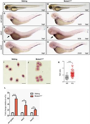 Tpr Deficiency Disrupts Erythroid Maturation With Impaired Chromatin Condensation in Zebrafish Embryogenesis